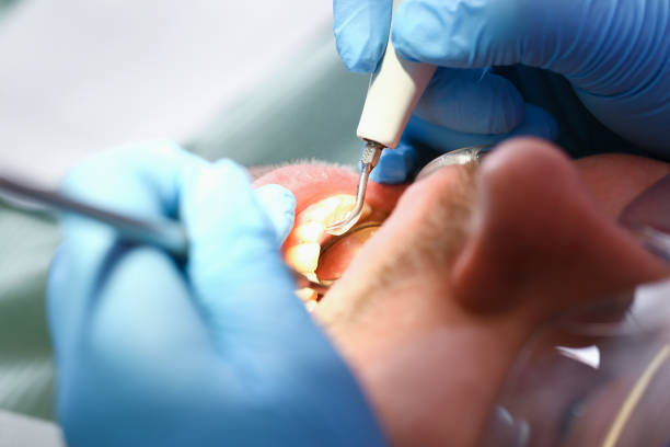 Best Broken or Chipped Tooth Repair in Mcadoo, PA