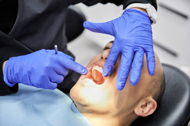 Best Emergency Wisdom Tooth Extraction in Mcadoo, PA